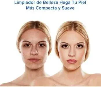 Maquina para eliminar puntos negros